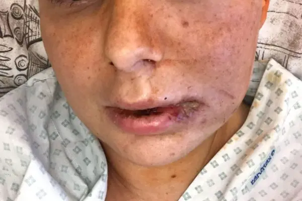 Zuzka Ferková - příběh Hero - obrázek 1